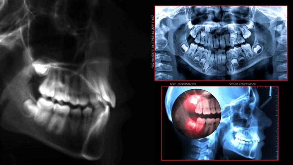 лечение зубов и имплантация в Черкассах и области