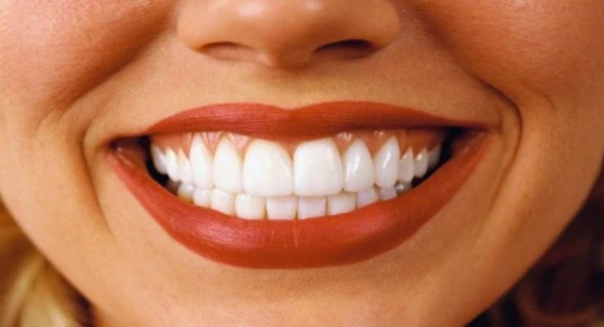 фото женской улыбки после лечения зубов