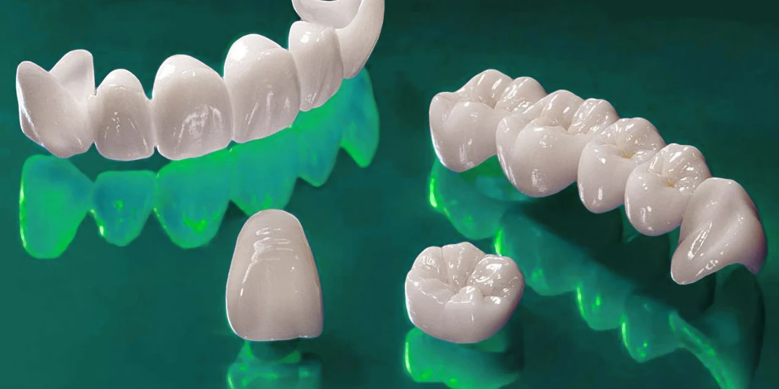 на фото керамические коронки для протезирования в стоматологической клинике Багита в Черкассах