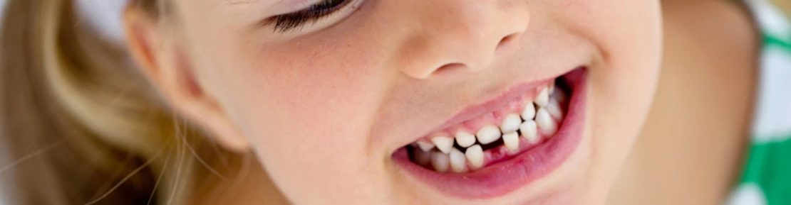 фото дитини з молочними зубами
