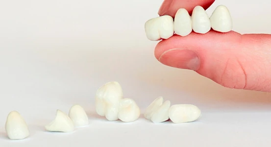 коронки для зубов в стоматологической клинике в Черкассах Багита