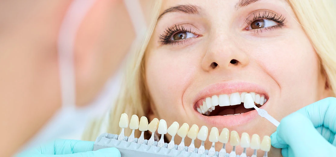 подбор цвета для протезирования зубов в стоматологической клинике Багита