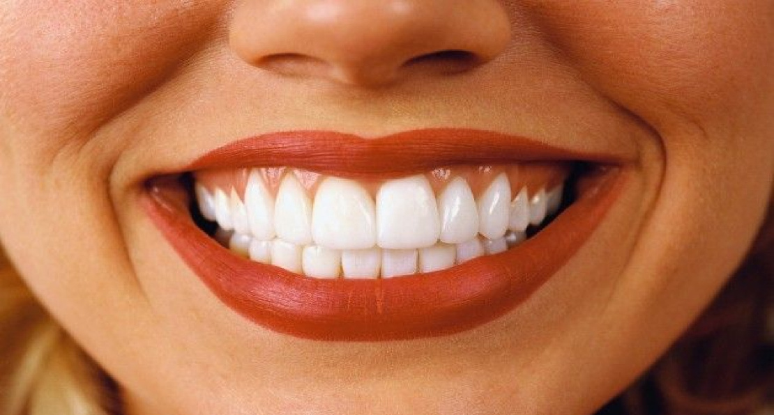 photo of a woman's smile after dental treatment