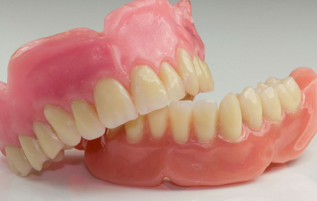 на фото стоматологічні протези для встановлення в стоматологічній клініці Багіта в Черкасах