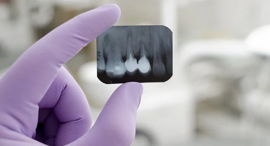 Dental X-ray in Cherkassy dentistry