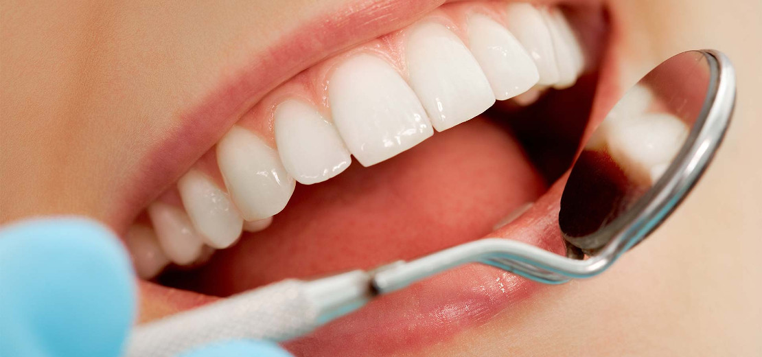 professional teeth cleaning by a dental hygienist at Bagita Dentistry in Cherkassy
