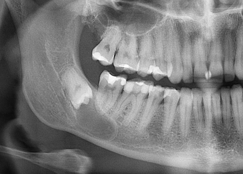 Тест: в порядке ли ваши зубы?